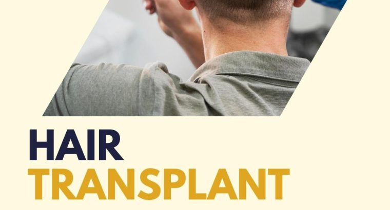 FUT and FUE hair transplant services in Islamabad